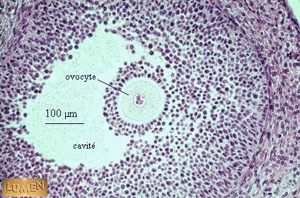 follicule cavitaire développé